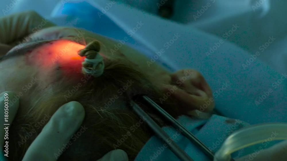 Doctor with an endoscope picks up the patient's skin during a facelift Doctor with an endoscope picks up the patient's skin during a facelift