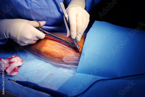 Billede på lærred Surgeon begins to work in the operating room with a skin incision at the surgica