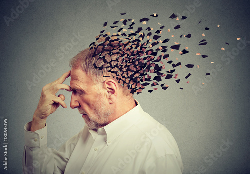 Memory loss due to dementia. Senior man losing parts of head  as symbol of decreased mind function. photo