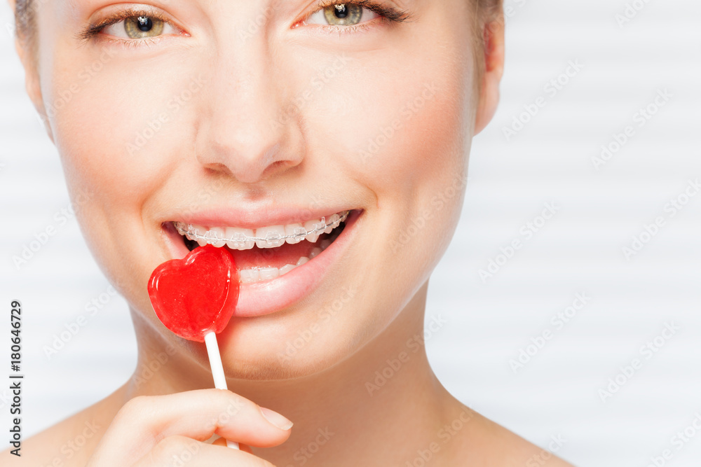 Woman with dental braces biting red lollipop StockFoto Adobe Stock