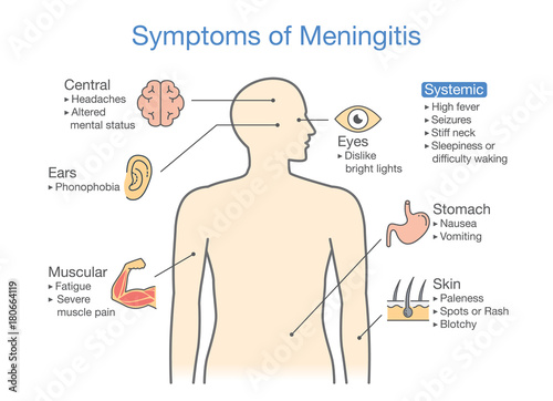Symptoms of Meningitis patient. Diagram to showing signs of disease.