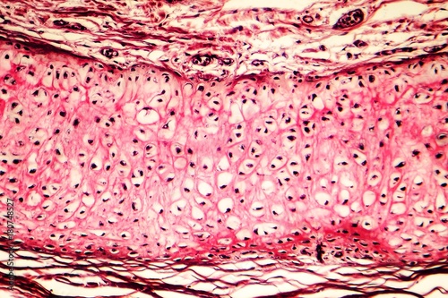 Elastic cartilage of human outer ear, light micrograph photo