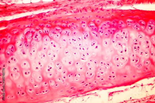 Tableau sur toile Hyaline cartilage of human trachea, light micrograph