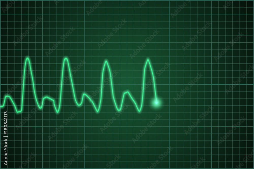 Heart monitor pulse. Heartbeat line. Vector heart rate chart. Vector illustration. Heart monitor pulse. Heartbeat line. Vector heart rate chart. Vector illustration.