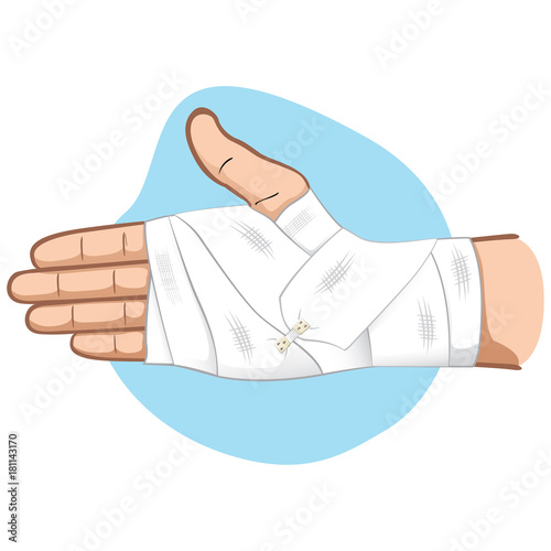 Illustration first aid hands with bandage bandage in the palm and wrist region, caucasian. Ideal for medical, informative and institutional catalogs