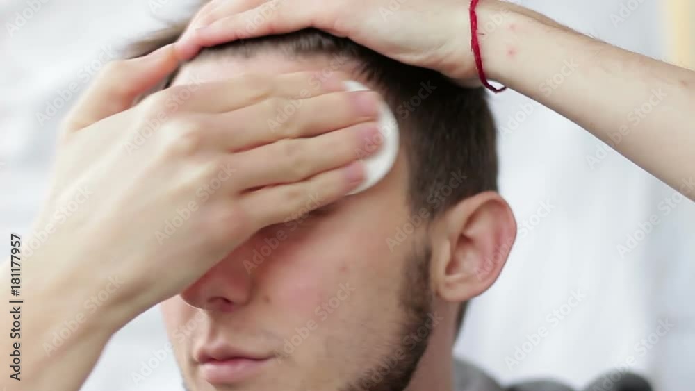 A young handsome man applying an antiseptic to clean the skin of the face. Disinfectant effect A young handsome man applying an antiseptic to clean the skin of the face. Disinfectant effect