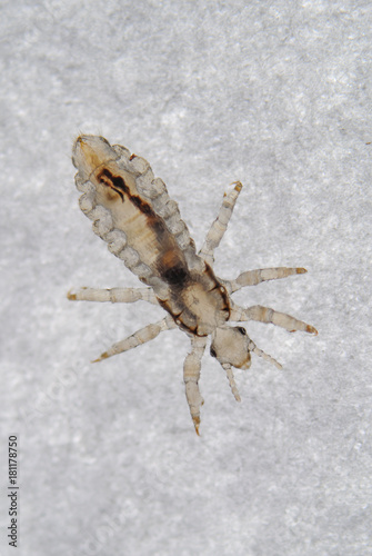 Head louse - Head lice