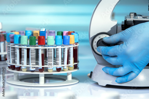 doctor examining in the microscope sample of blood test in the laboratory /hand of technician calibrating microscope in the lab with blood samples in the rack photo