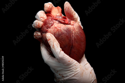 abstract illegal organ transplantation. A human heart in the hand of a surgeon woman. International crime. Assassins in white coats. Death and money. Heart transplant isolated on black background