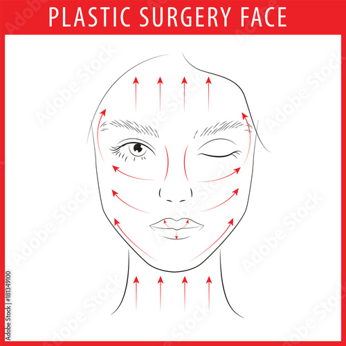 plastic surgery face