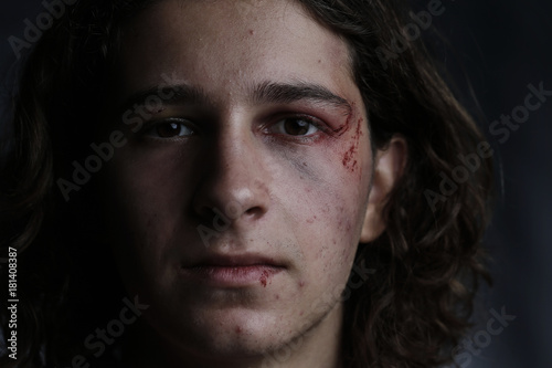 Quadro em tela Face bruise