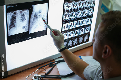 Carrying out a description of the radiographs of a patient with COPD photo