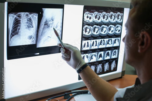 Carrying out a description of the radiographs of a patient with COPD