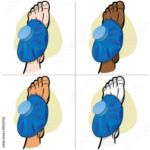 Illustration of firs aid person ethnicity, foot with thermal bag, puperior vision. Ideal for catalogs, information and medicine guides
