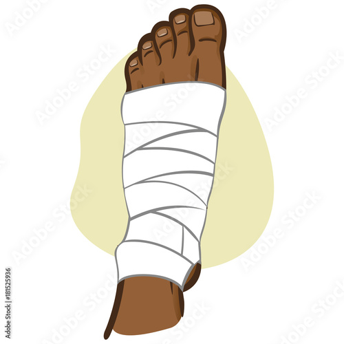 Illustration of firs aid person afro descent, bandaged foot, top view. Ideal for catalogs, information and medicine guides