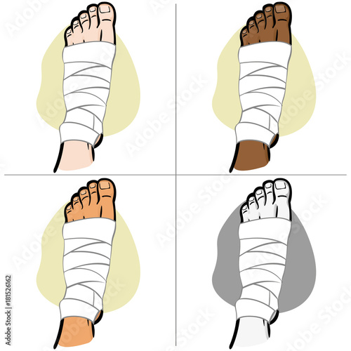 Illustration of firs aid person ethnicity, bandaged foot, top view. Ideal for catalogs, information and medicine guides