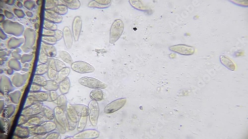 Microscope image footage of protozoa microorganisms in water, showing ciliates, paramecium, bacteria spirochaete and algae. photo