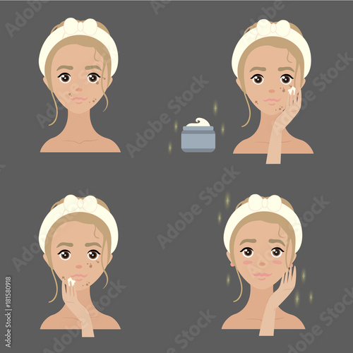 Steps how to apply anti pigmenation facial cream