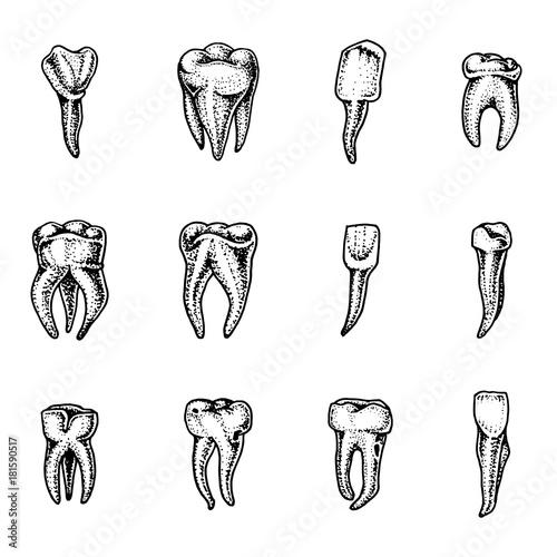 molar teeth enamel, dental set. work of the dentist and care for children. oral cavity clean or dirty. health or caries human. engraved hand drawn in old sketch, vintage style. symbol of medicine.