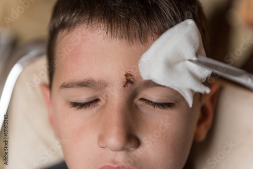 Young boy with injured forehead. Wound cleaning treatment
