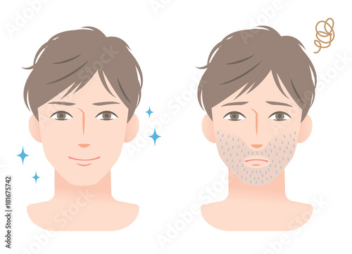 男性　ヒゲ　ビフォアアフター