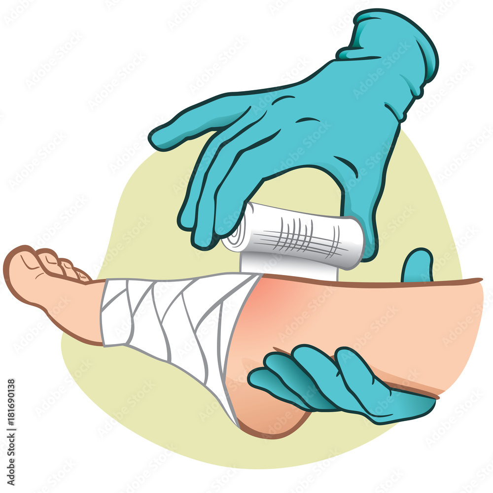 Φωτογραφία Illustration of First Aid person, caucasian, foot side view, hands with gloves bandaging the foot