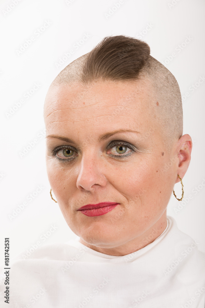 Obraz premium beautiful woman cancer patient