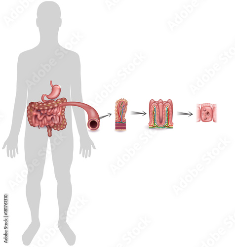 Small intestine lining detailed anatomy, a fold of the intestinal lining, villi and epithelial cell with microvilli