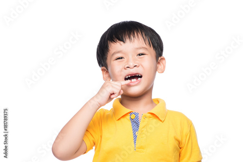 Lost milk tooth asian boy, Close up view.