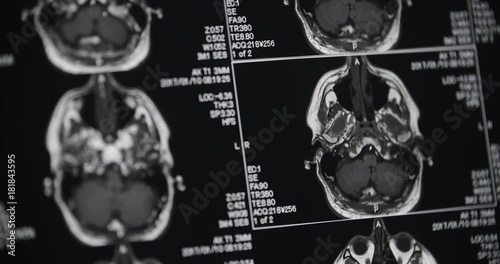 MRI Head Scans Close Up Pan Right. view pans right on a close up of a mri multiple head scans with one moving through the layers of the head