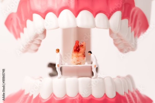 miniature people and dental model,dental care concept photo