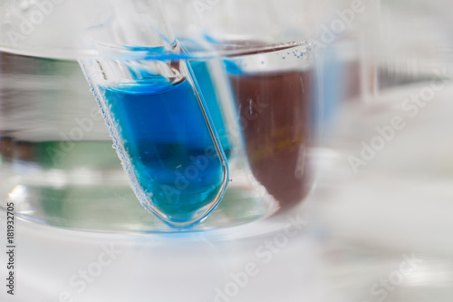 Experiment chemical of urine with Benedict s solution in the laboratory.	