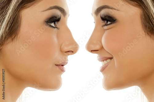Comparison of female nose  before and after plastic surgery