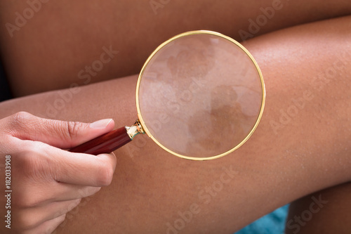 Woman Holding Magnifying Glass Looking At Skin