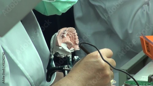 Close-up of the hands of a dental technician applying hot wax in a mold in a workshop. Dental prosthesis laboratory. photo