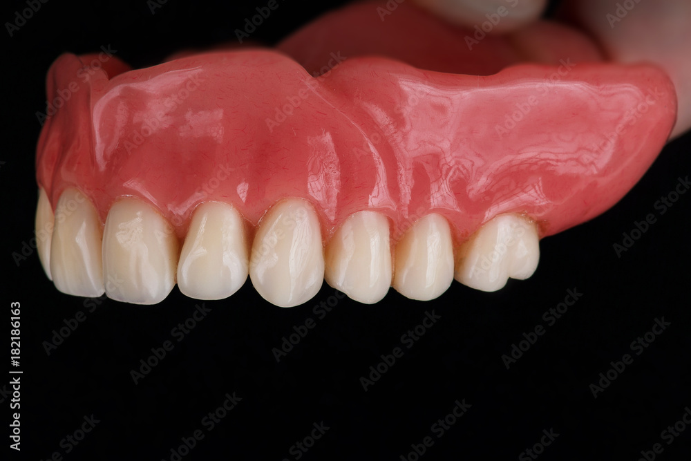 upper part of denture, taken at an angle on a black background