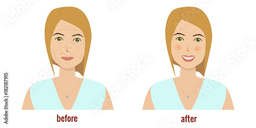 Face of a woman before and after facial treatment. Rejuvenation