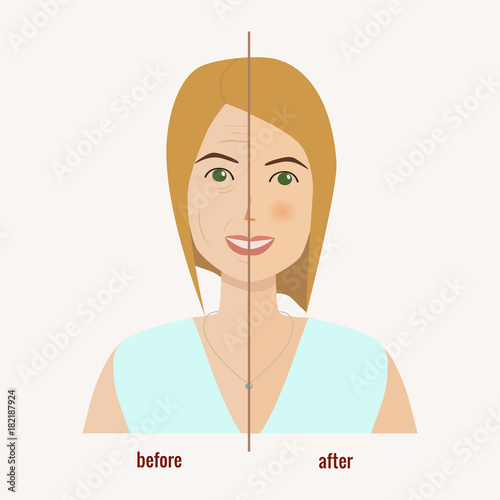 Face of a woman before and after facial treatment. Rejuvenation of the skin concept. Collagen. Cosmetic surgery