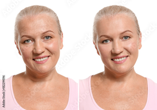 Mature woman before and aft...