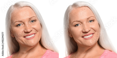 Mature woman before and aft...