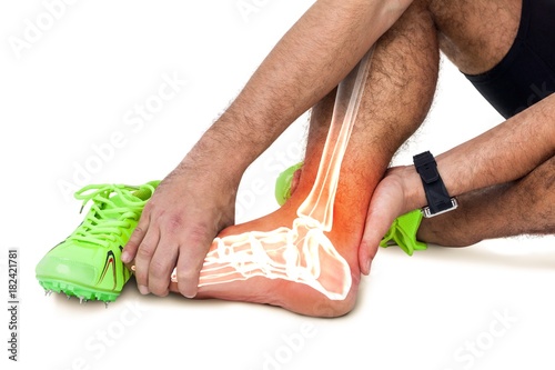 Highlighted leg bones of injured man against white background