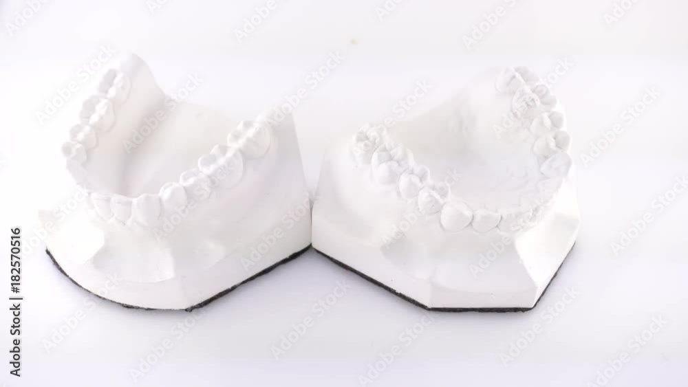 Hand of female doctor holding orthodontic dentures of ceramics Hand of female doctor holding orthodontic dentures of ceramics