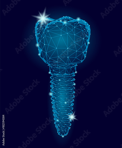 Molar tooth dental implant 3d low poly geometric model. Dentistry innovation future technology titan metal thread. Medical healthy science blue polygonal point line vector illustration photo