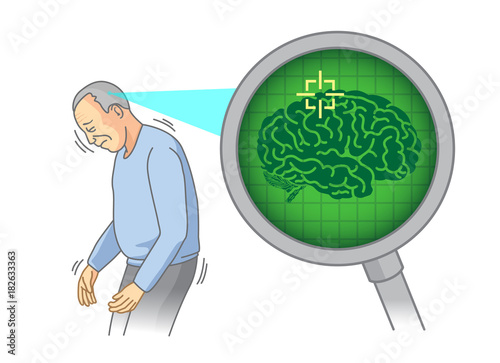 Check inside of the elderly brain with Magnifying glass. Illustration about Medical scan concept.