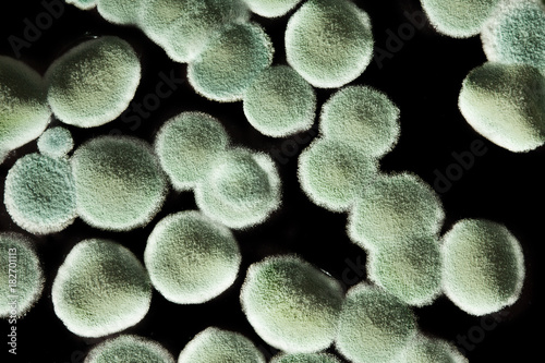mold on juice, on drink. Harmful to human health. top view.