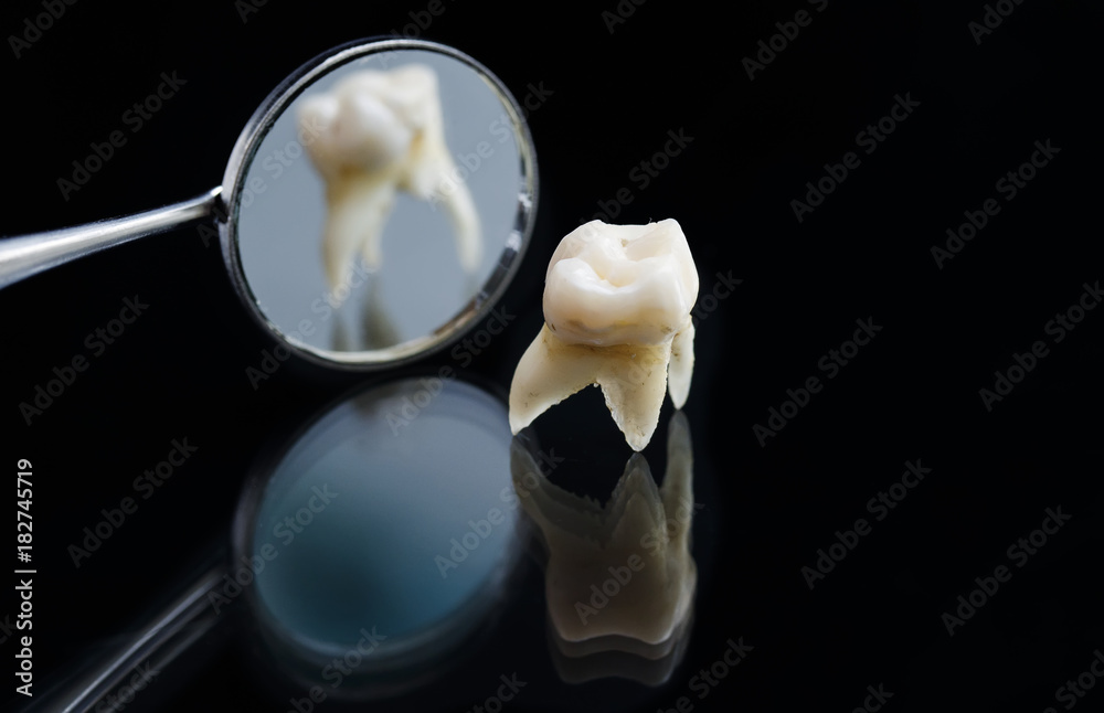 Pulled Rotten Tooth bad rotten tooth is pulled out and is located opposite the dental ...