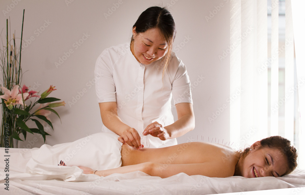 The doctor sticks needles into the woman's body on the acupuncture - obrazy, fototapety, plakaty 