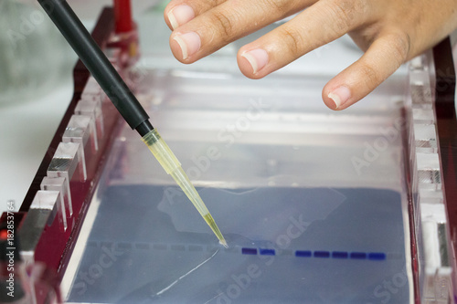 Agarose gel electrophoresis is a method of gel electrophoresis used in biochemistry, molecular biology, genetics, and clinical chemistry to separate a mixed population of macromolecules such as DNA or photo