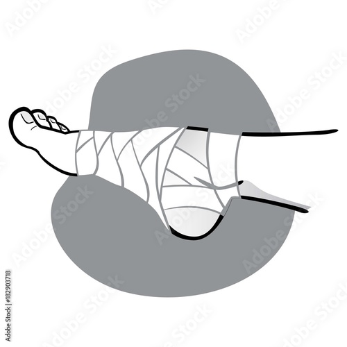 Illustration of first aid, person with bandaged foot, side view. black and white. Ideal for catalogs, information and medicine guides