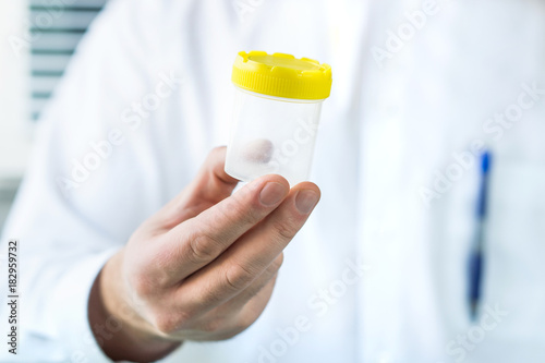 Doctor holding urine sample cup. Medical test in hospital. photo